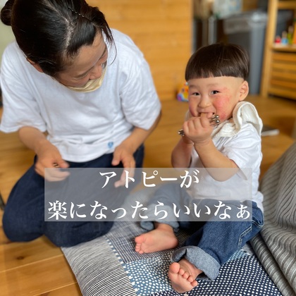 アトピーのケア